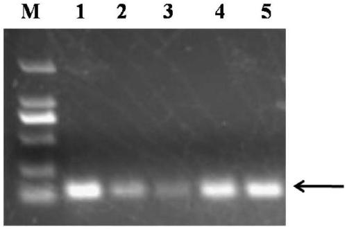 Soybean GmST1 gene mutant plant and preparation method thereof