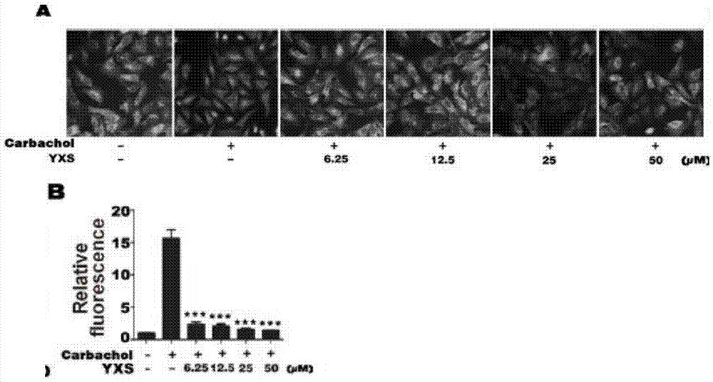 Application of ginkgolic acid in the preparation of drugs for preventing and/or treating diseases caused by overactivation of osteoclasts