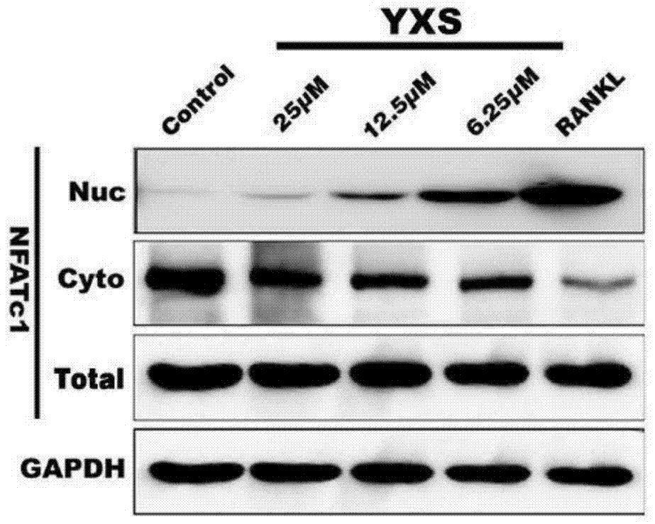 Application of ginkgolic acid in the preparation of drugs for preventing and/or treating diseases caused by overactivation of osteoclasts