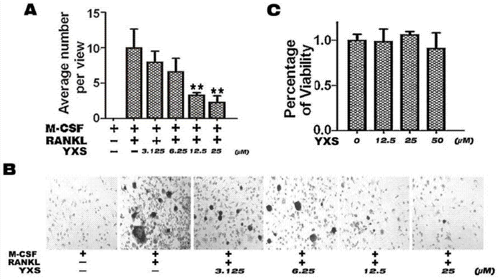 Application of ginkgolic acid in the preparation of drugs for preventing and/or treating diseases caused by overactivation of osteoclasts