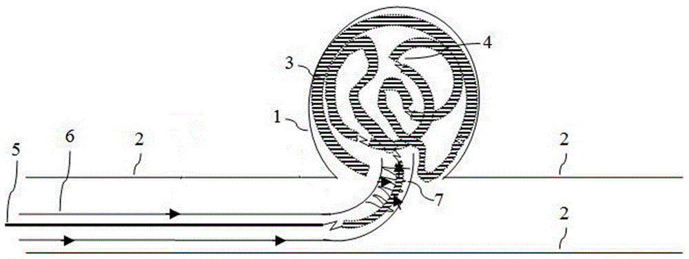 Multi-point electrolytic detachment system and method for detaching embolism materials