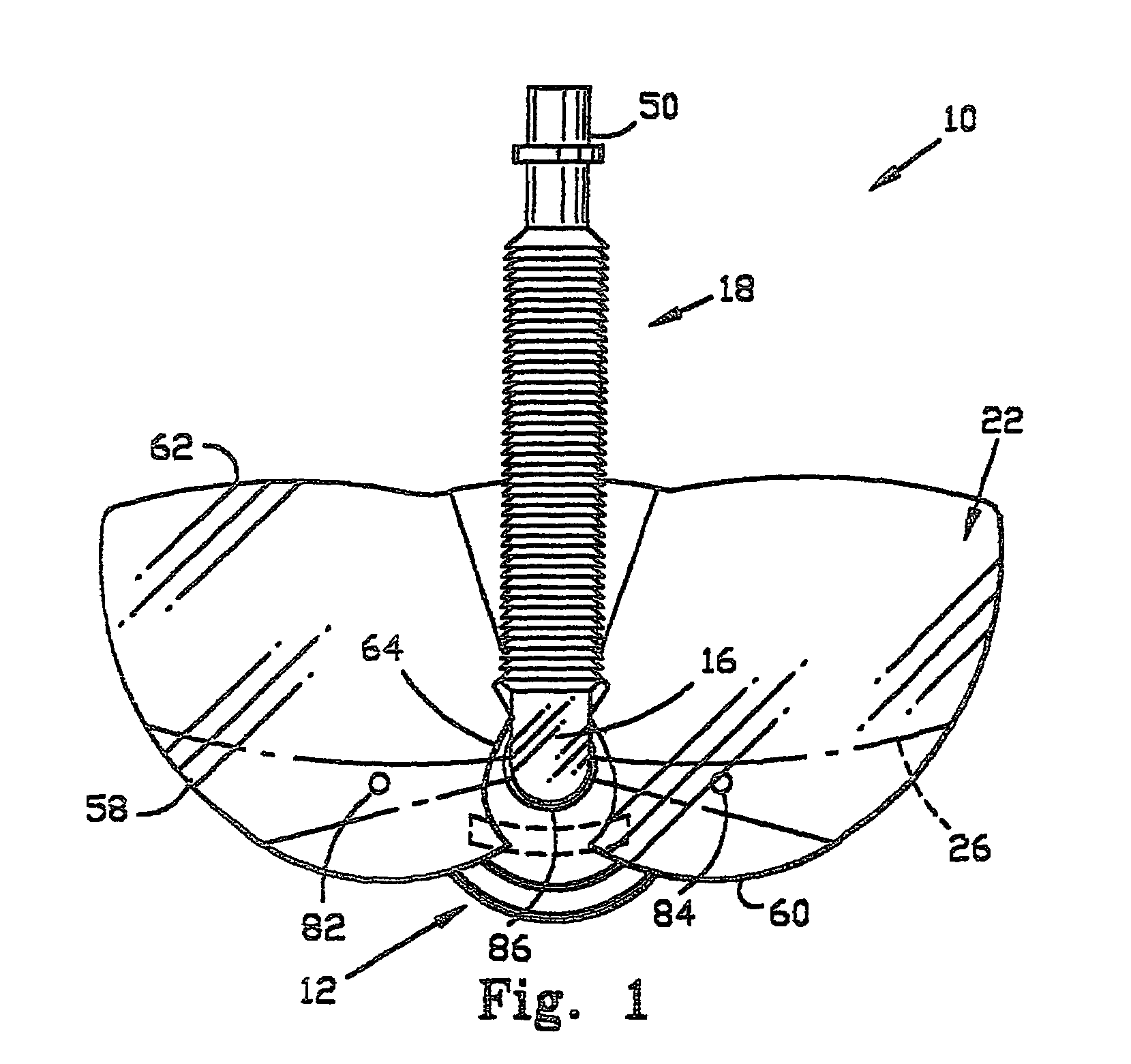 Anesthesia administration mask and eye shield