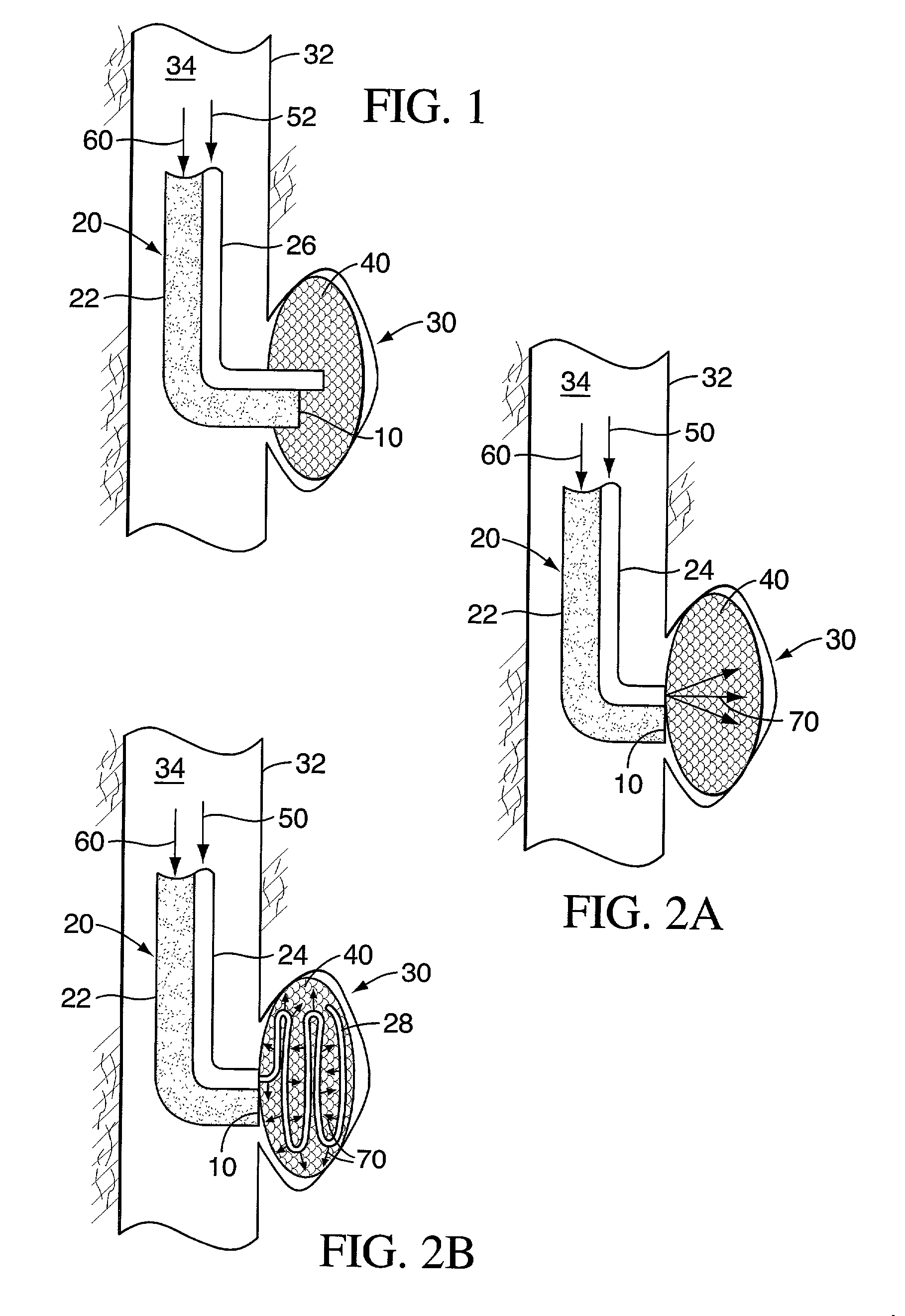 Method and apparatus for delivering materials to the body