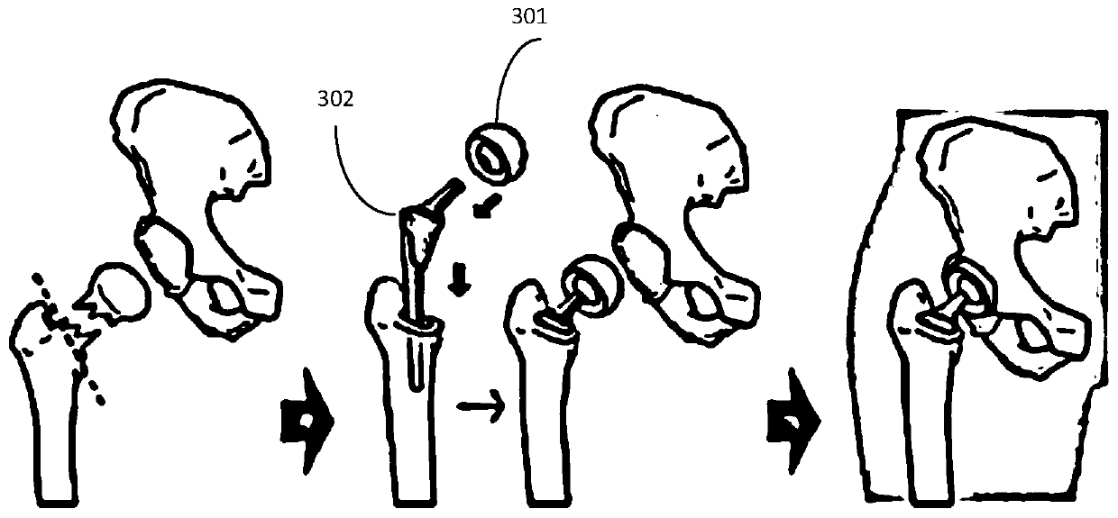 Hip joint image processing method based on deep learning and computing equipment