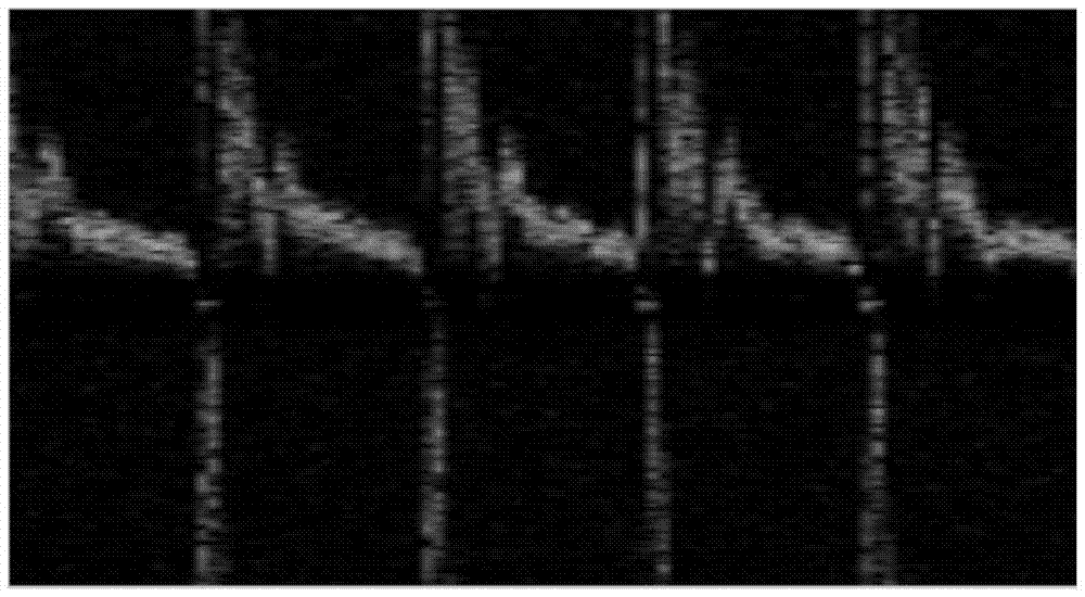 Ultrasonic system Doppler signal gap interpolation method and system