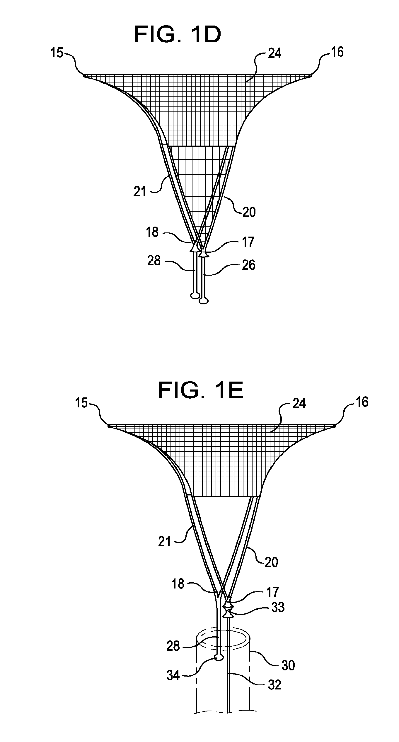 Systems and methods for supporting or occluding a physiological opening or cavity