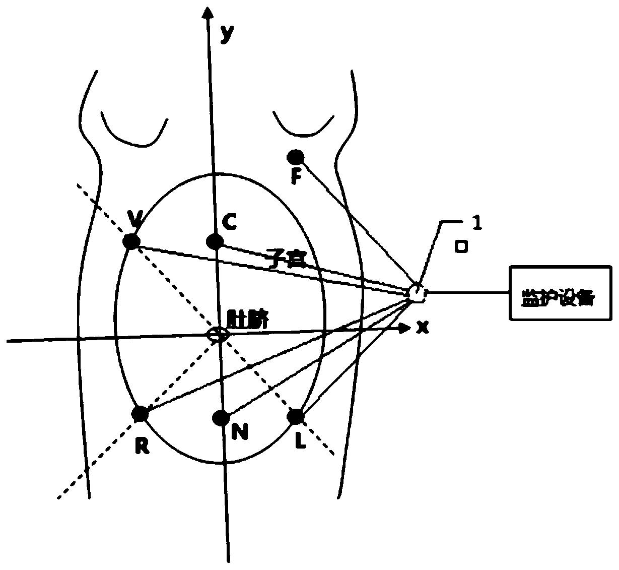 Electrode system, and method and device for acquiring and measuring foetus electrocardiosignal