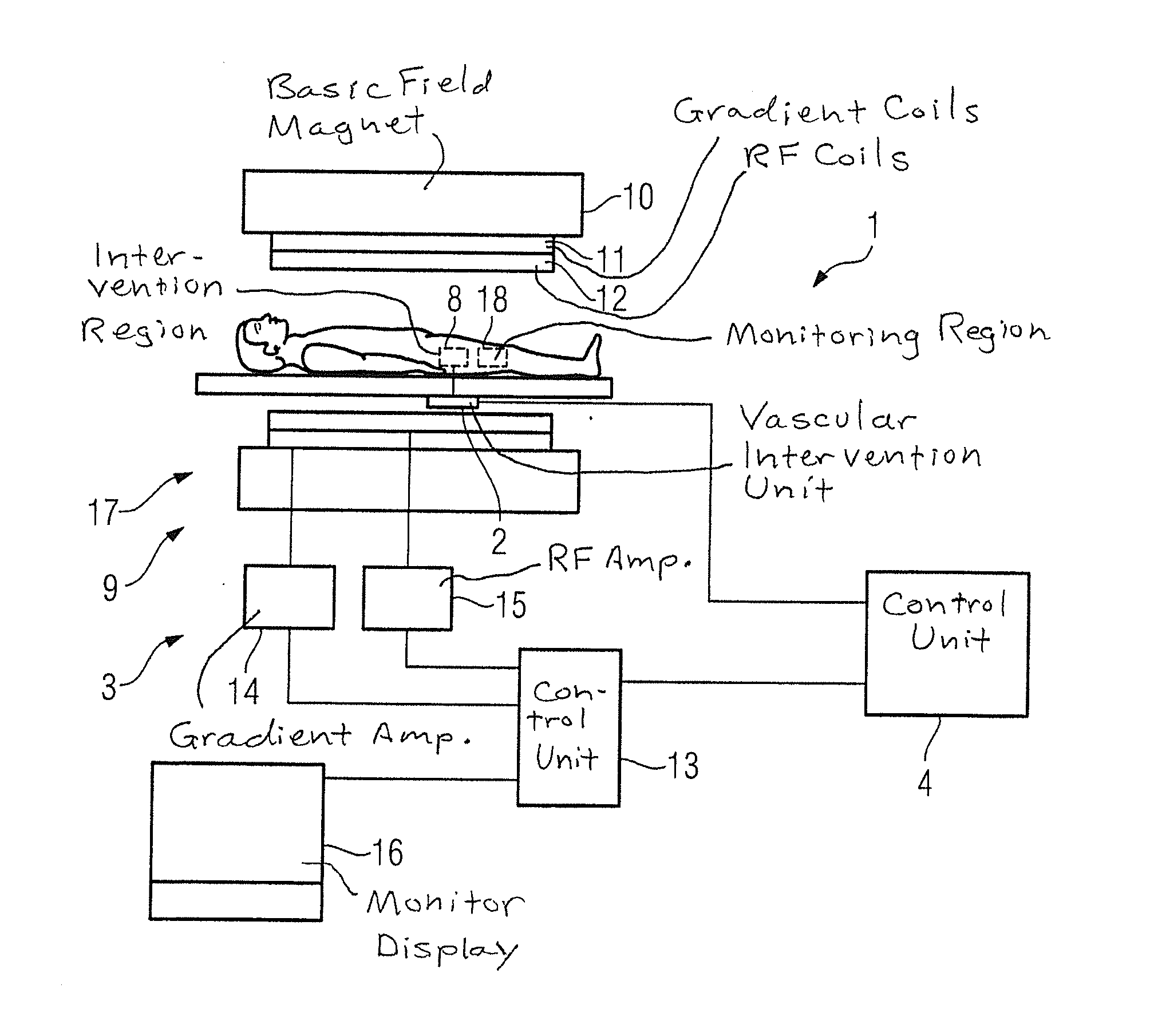 Method for a regulation of a vascular intervention, and device to regulate a vascular intervention