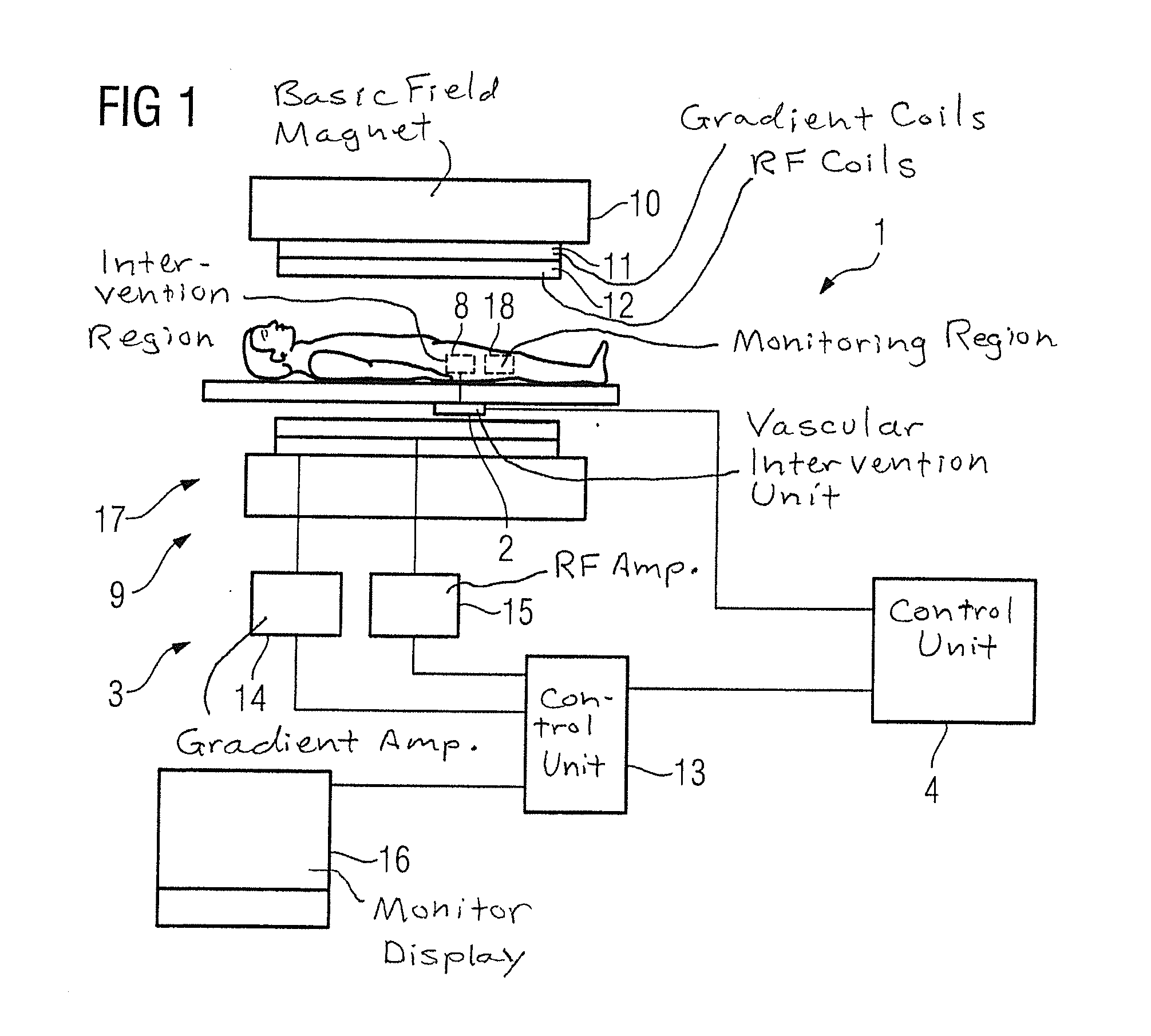 Method for a regulation of a vascular intervention, and device to regulate a vascular intervention