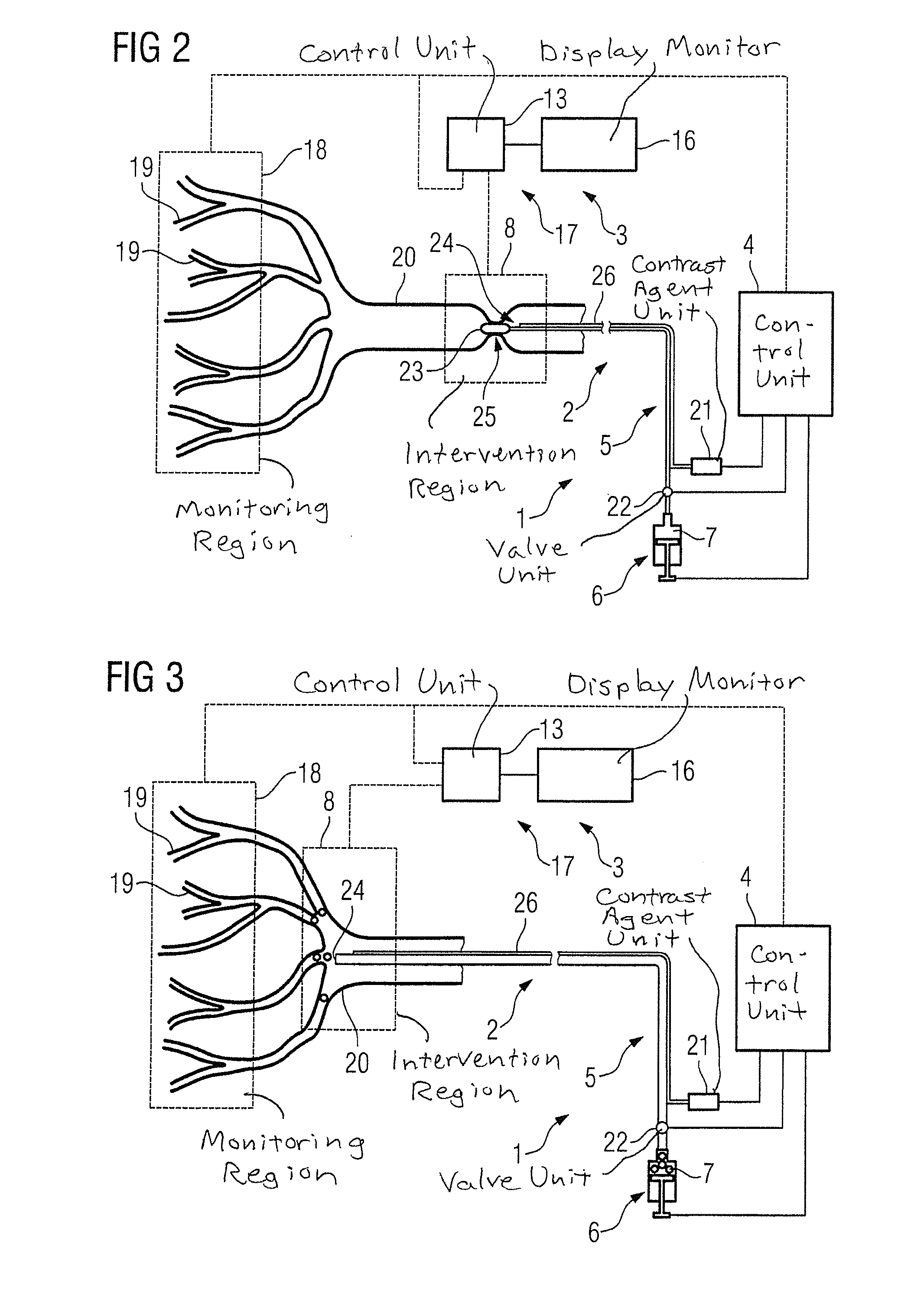 Method for a regulation of a vascular intervention, and device to regulate a vascular intervention