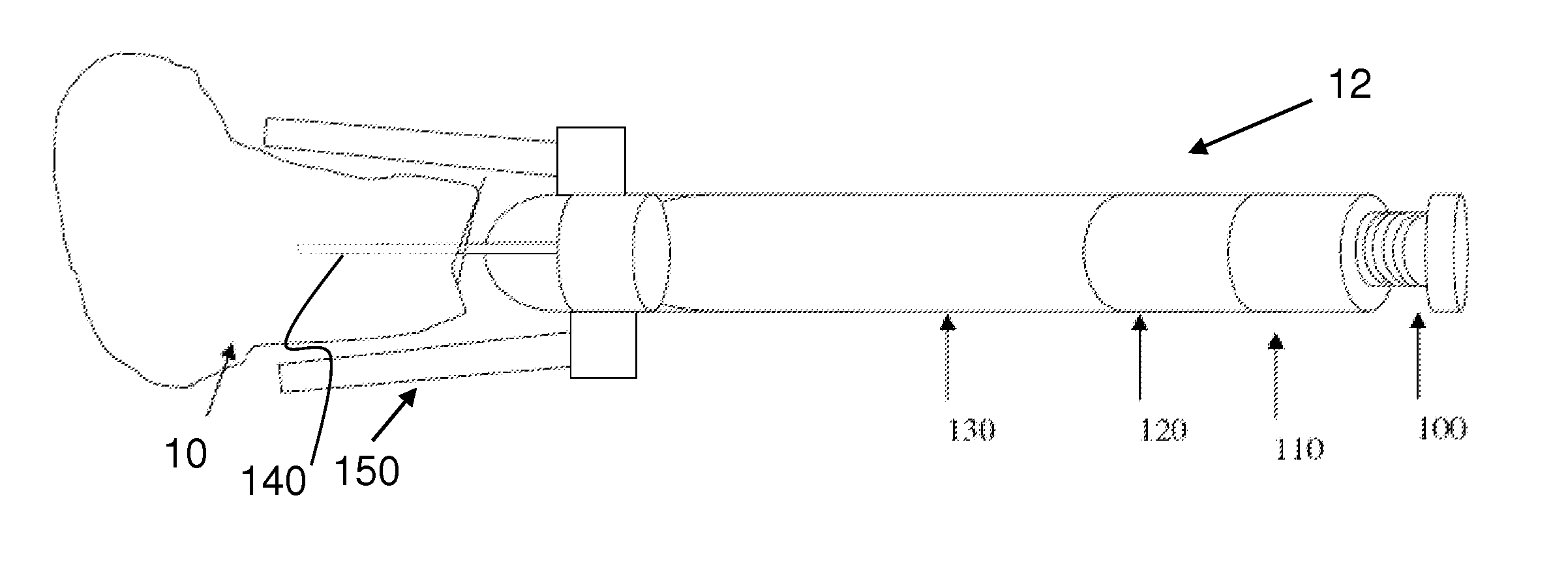 Device and method for drug delivery to a targeted skin layer