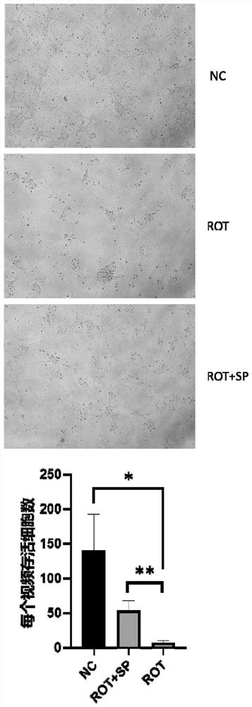 Application of sodium phenylbutyrate in preparation of medicine for preventing or treating Parkinson's disease