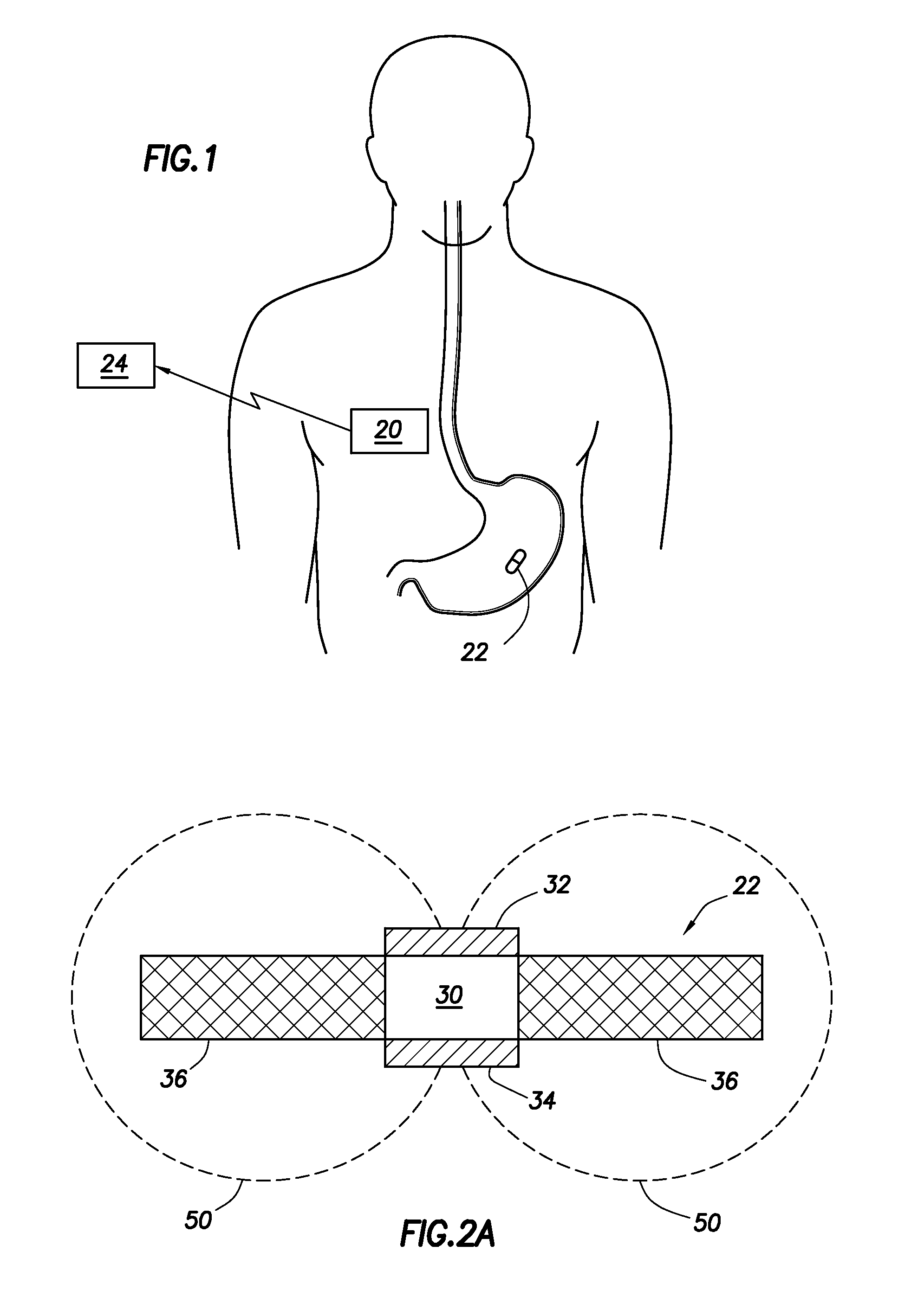 Evaluation of gastrointestinal function using portable electroviscerography systems and methods of using the same