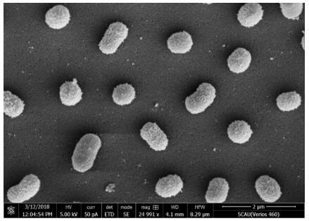 Microbial quorum sensing signal molecular quenching strain and application thereof in biological control of diseases