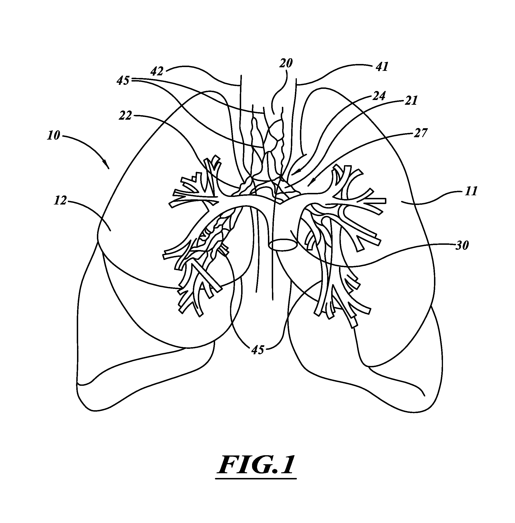 Apparatus for injuring nerve tissue