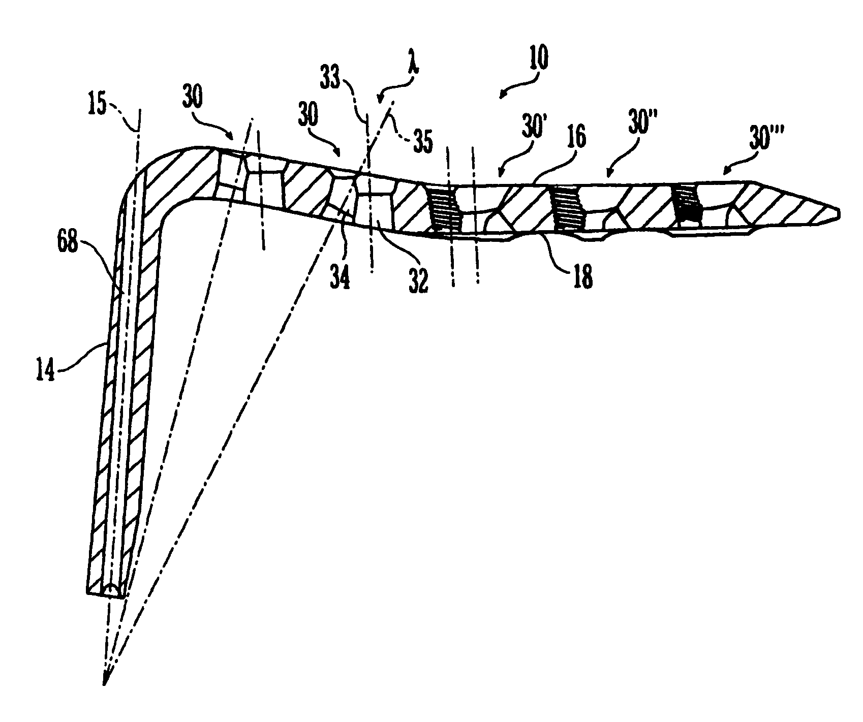 Bone plate with bladed portion