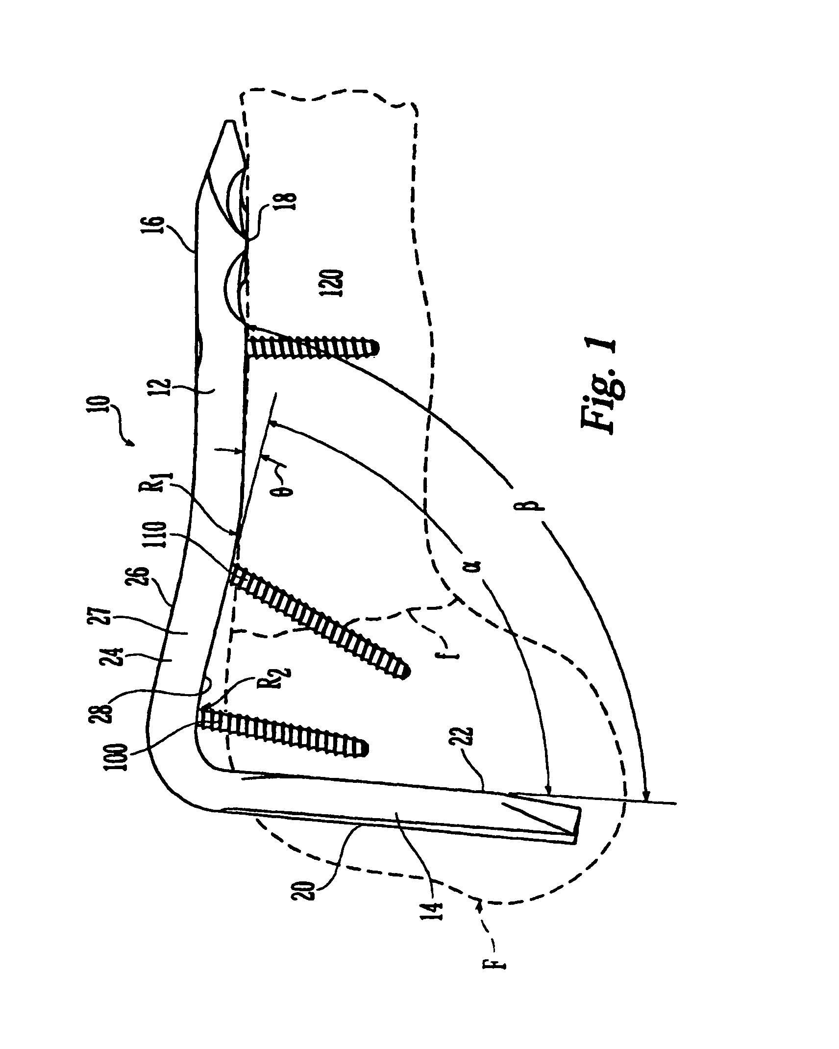 Bone plate with bladed portion