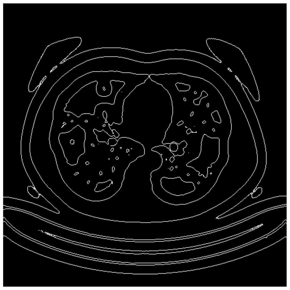 A Segmentation Method of CT Chest X-ray Lung Tissue Image Based on Level Set