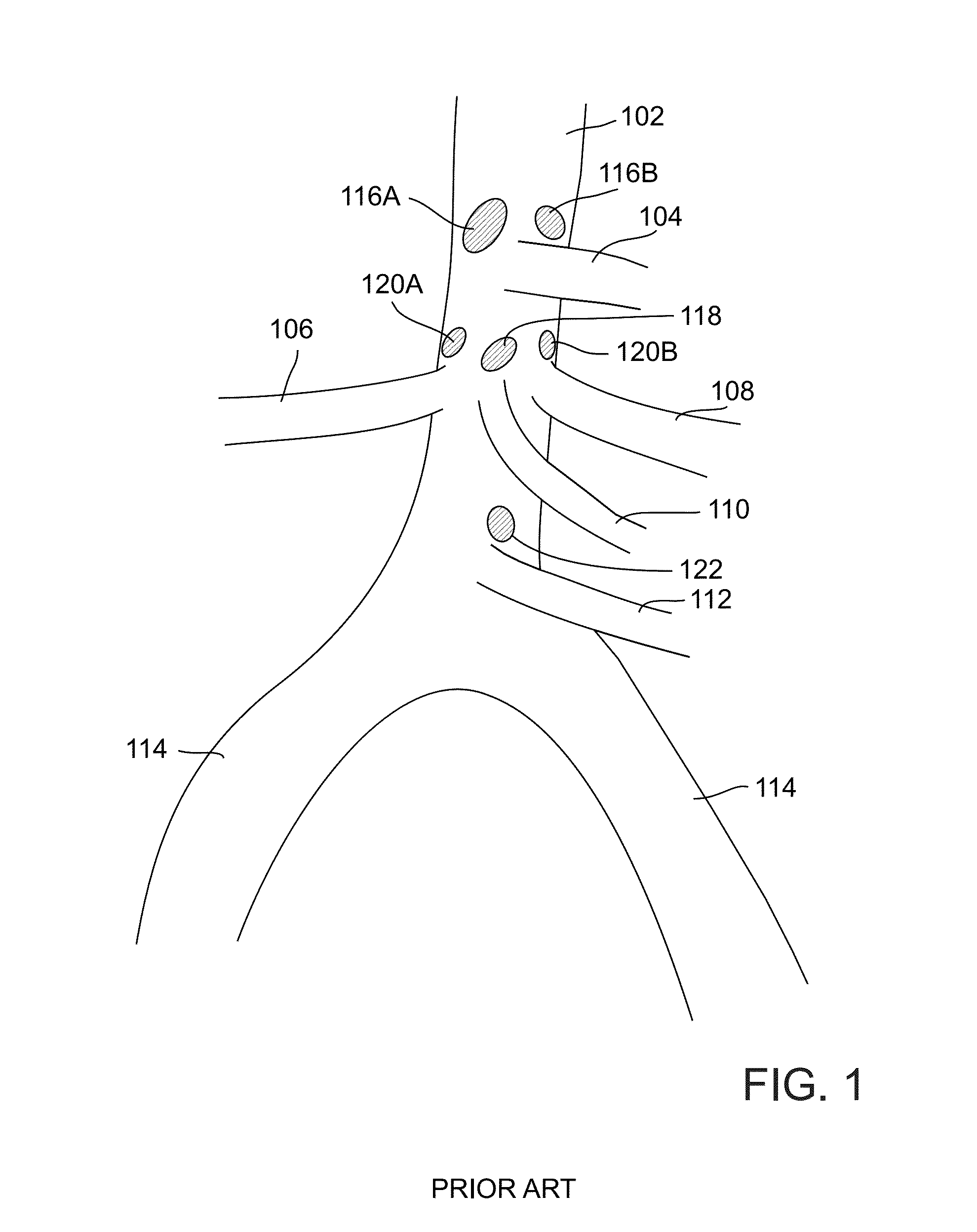 Methods and systems for treating nerve structures