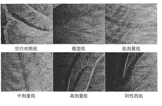 Application of acteoside in preparing medicine for treating alzheimer disease