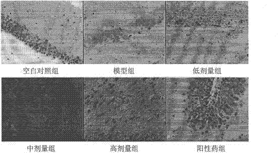 Application of acteoside in preparing medicine for treating alzheimer disease