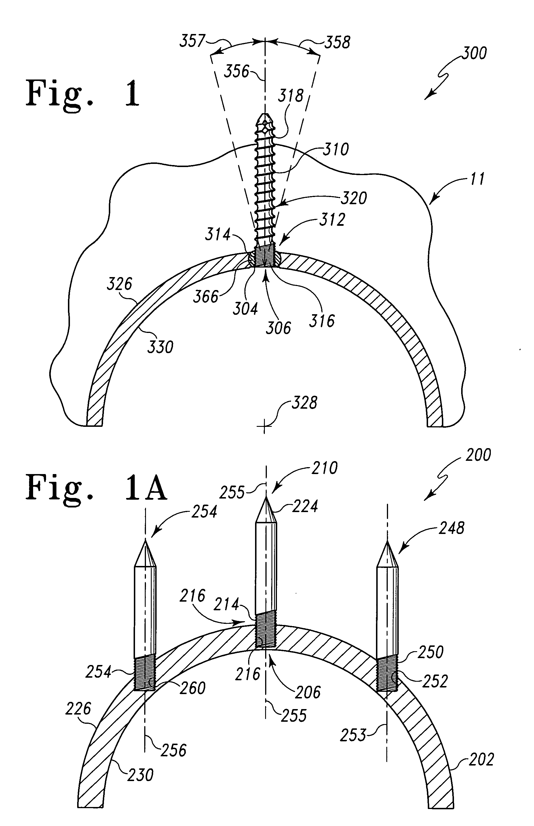 Acetabular cup with rigid fasteners