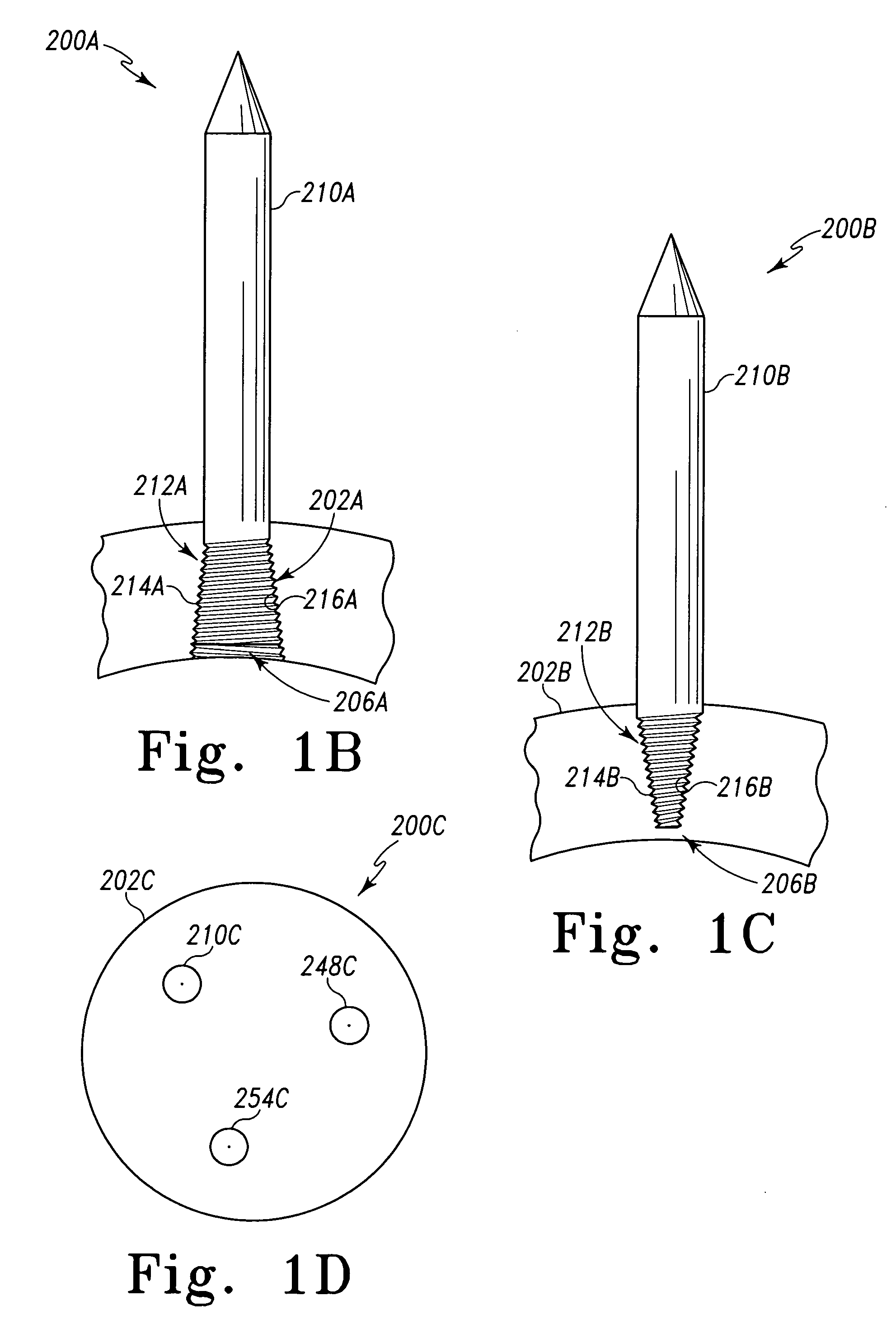 Acetabular cup with rigid fasteners