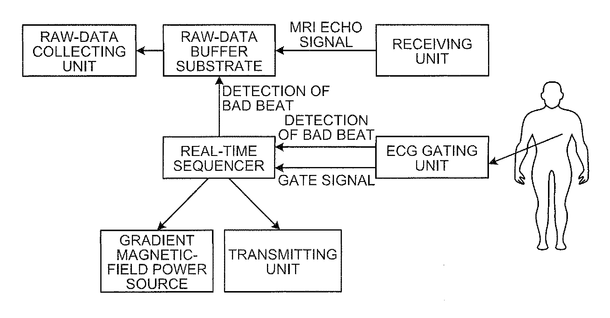 Magnetic resonance imaging apparatus and magnetic resonance imaging method