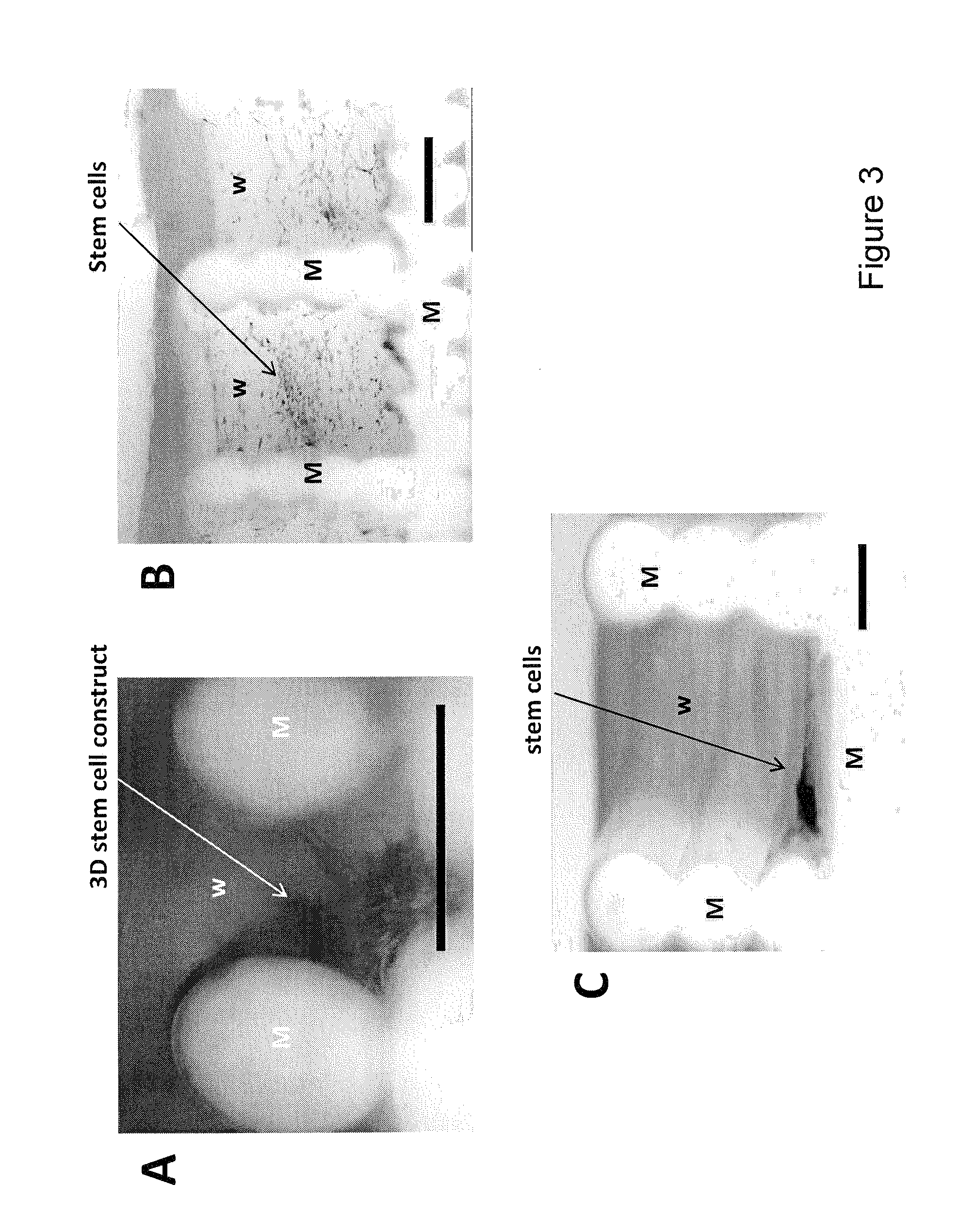 High throughput multiwell system for culturing 3D tissue constructs in-vitro or in-vivo, method for producing said multiwell system and methods for preparing 3D tissue constructs from cells using said multiwell system