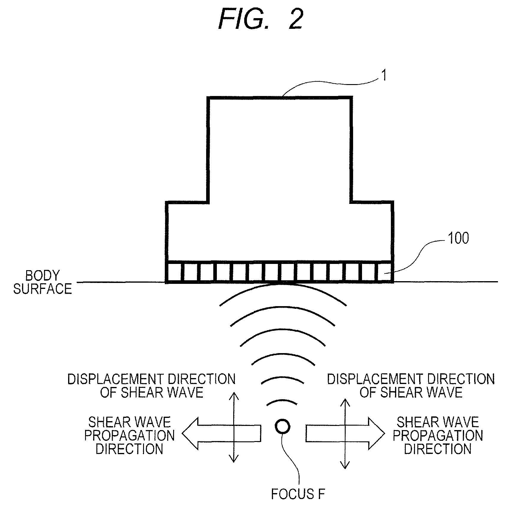 Ultrasound diagnosis apparatus