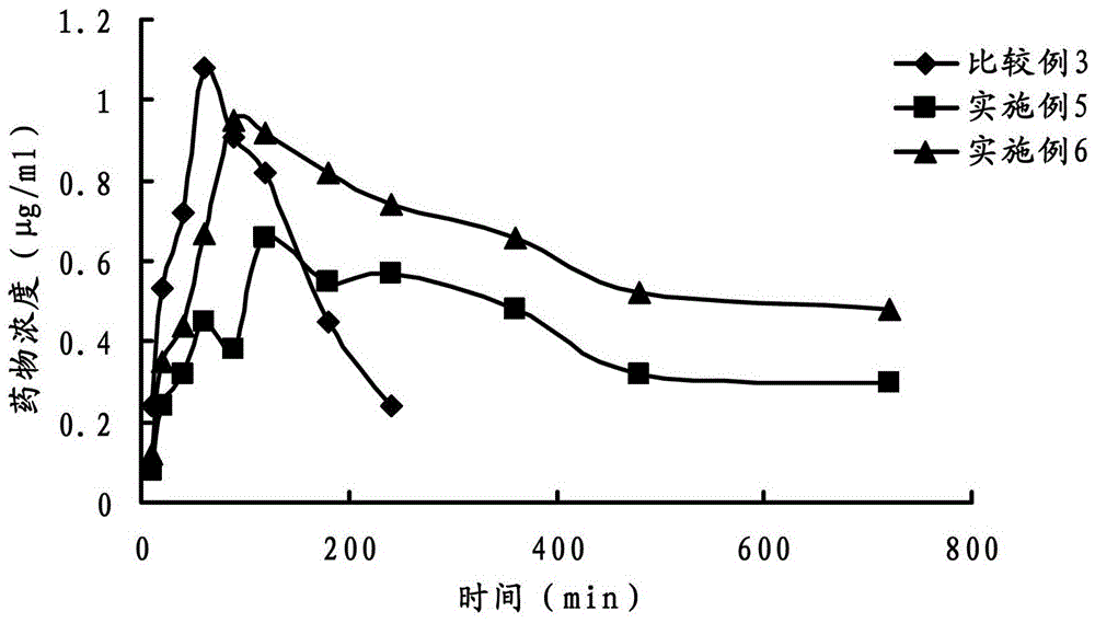 Ophthalmic gel containing dorzolamide and timolol and preparation method thereof