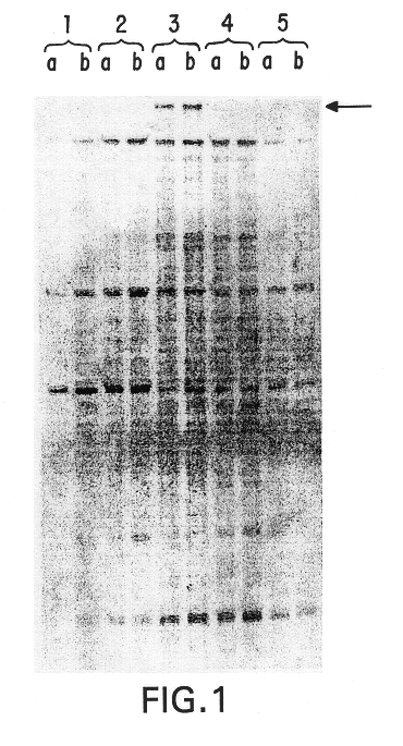 Compositions and methods for the treatment and diagnosis of immune disorders