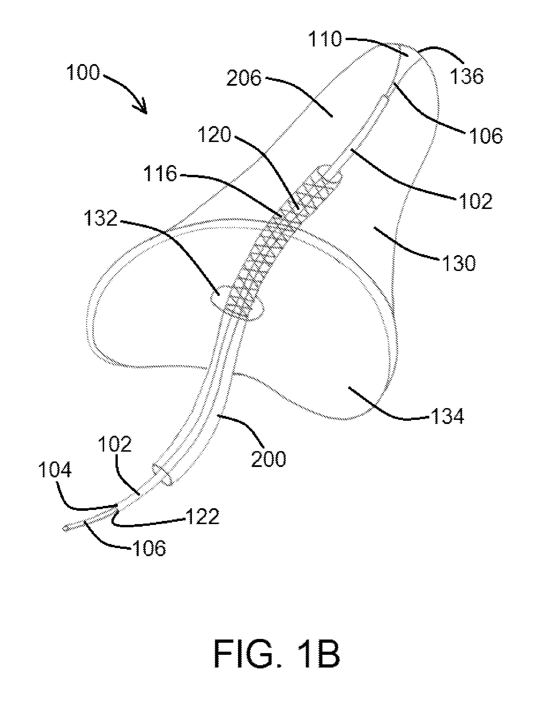 Devices, systems, and methods for inverting and closing the left atrial appendage