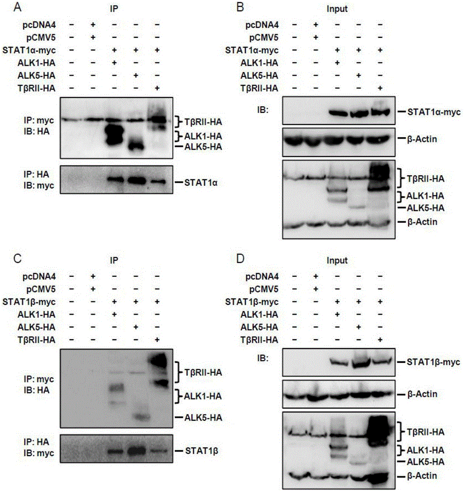 Application of STAT1 serving as ovarian cancer treatment target point