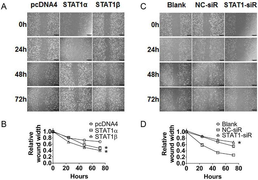 Application of STAT1 serving as ovarian cancer treatment target point