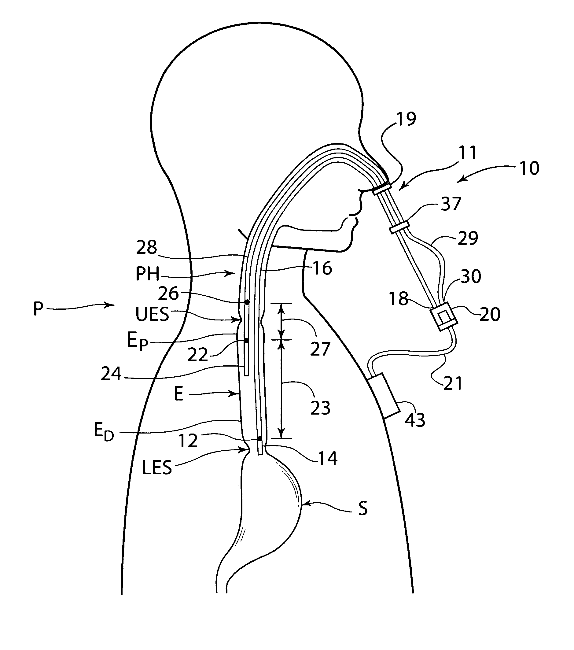 Pharyngoesophageal monitoring systems