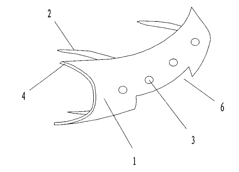 Encircling fixator for curing patella fracture