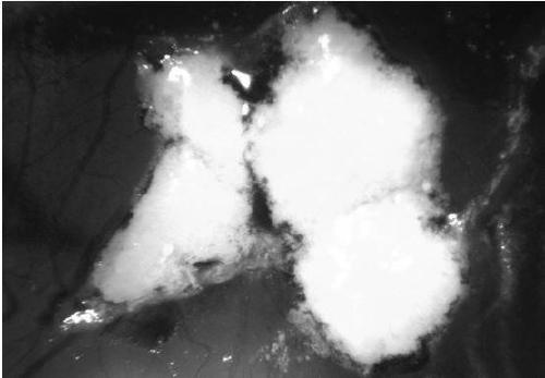 Method for constructing liver cancer patient-derived chick chorioallantoic membrane M-PDX model