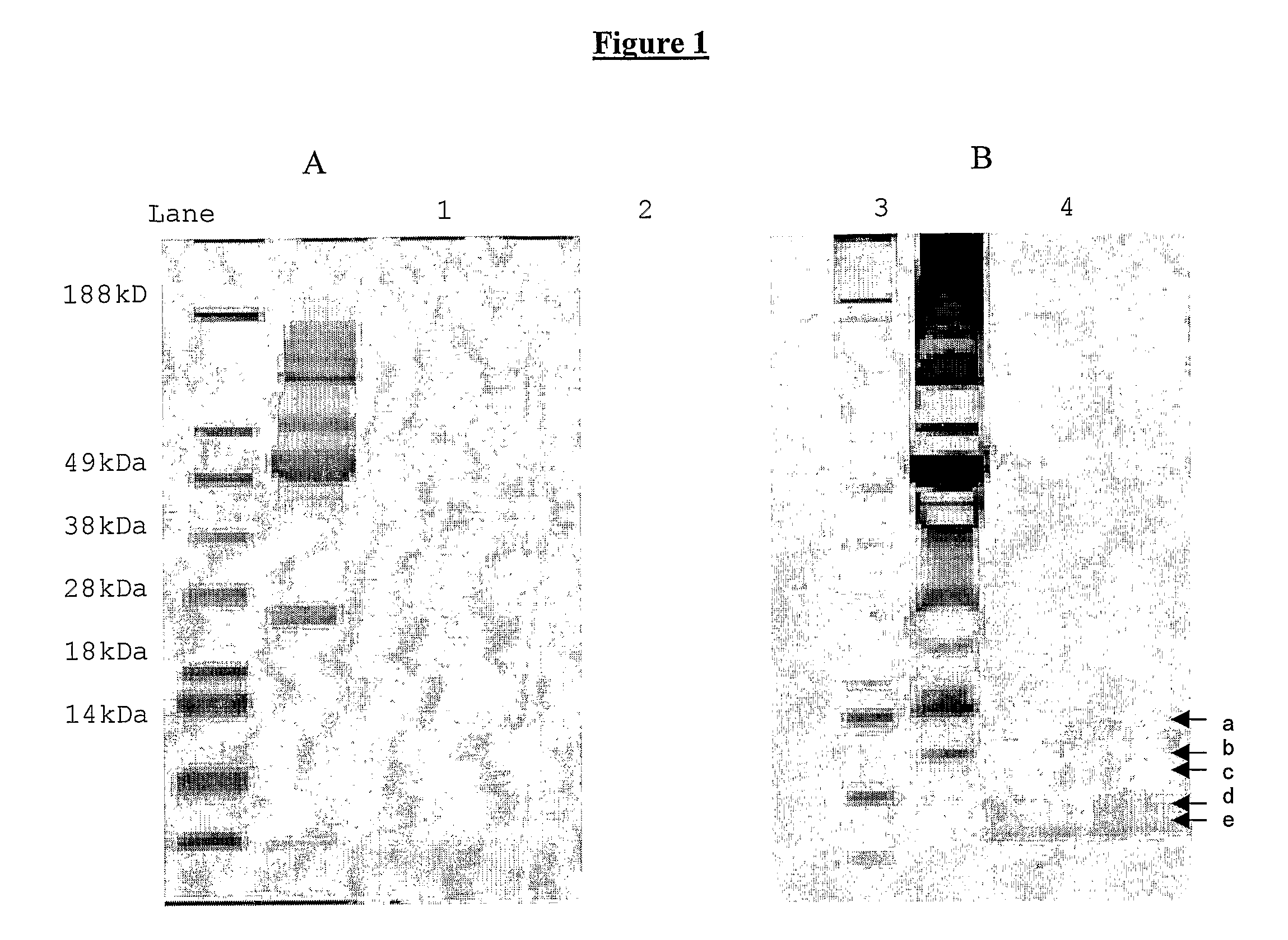 Detection of Disease Associated Proteolysis