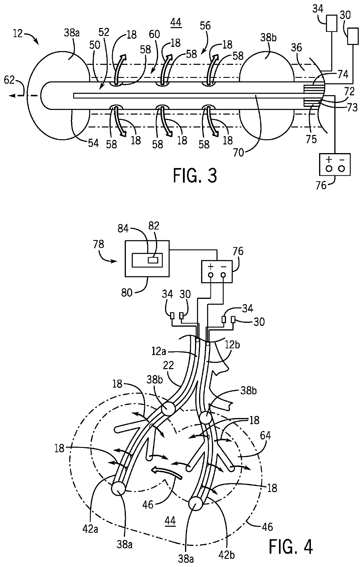 In Vivo Gene Therapy Delivery Procedure and Device