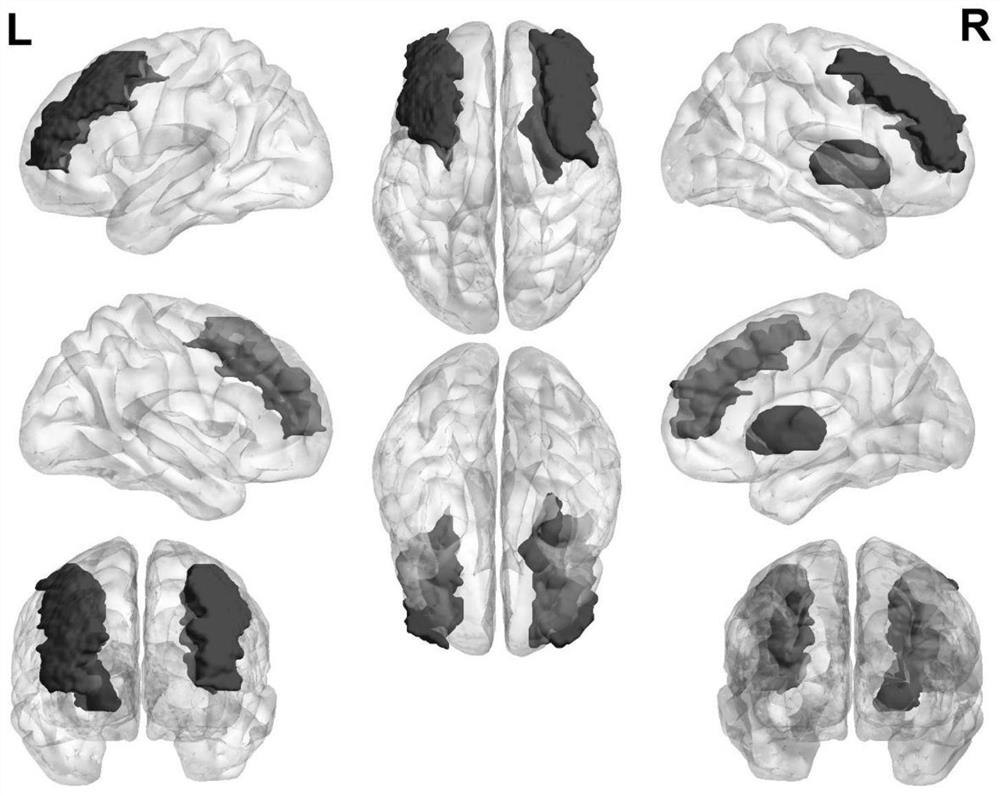 Multi-brain-region co-activation mode research method for teenager muscular spasm epilepsy