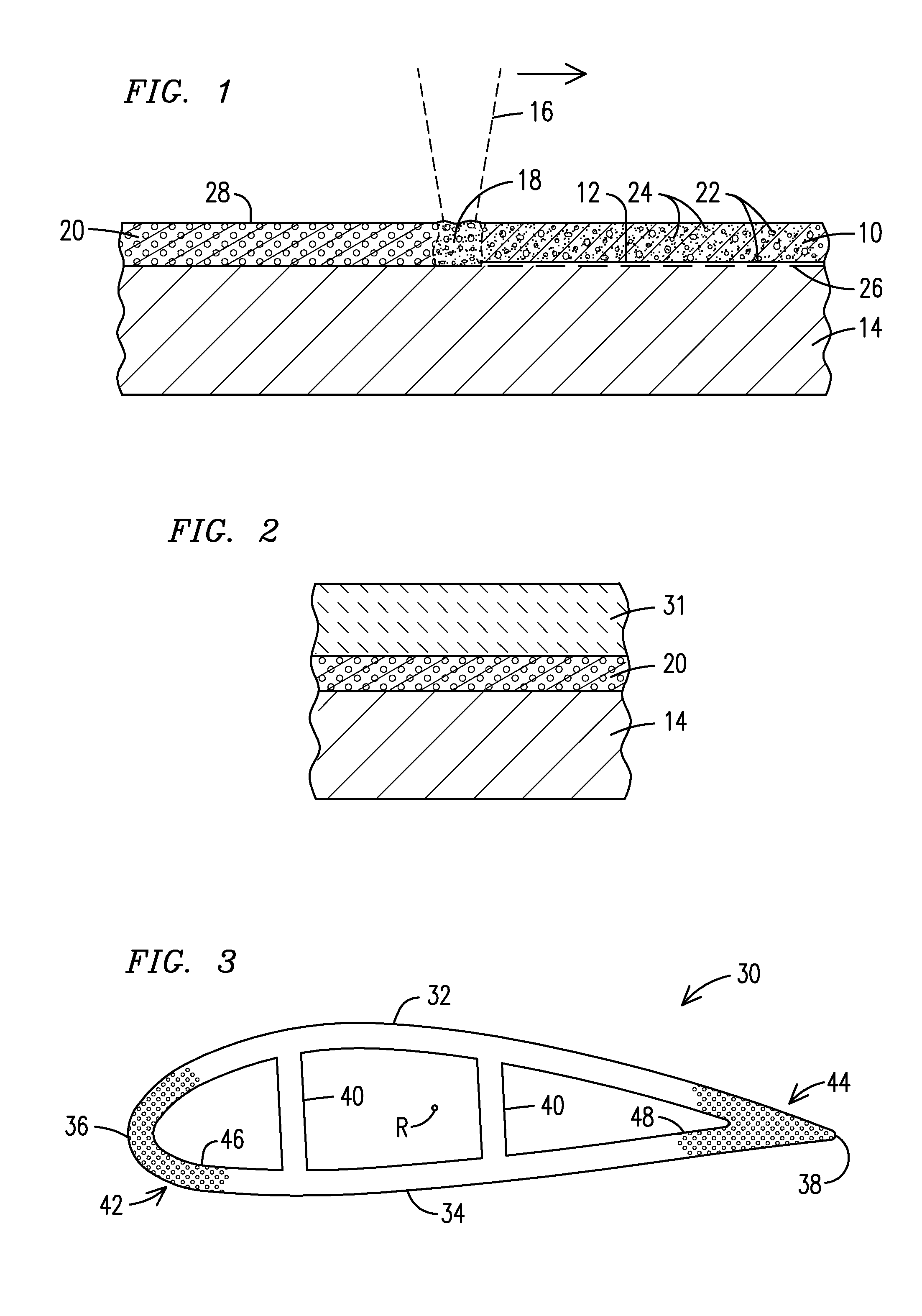 Laser deposition of metal foam