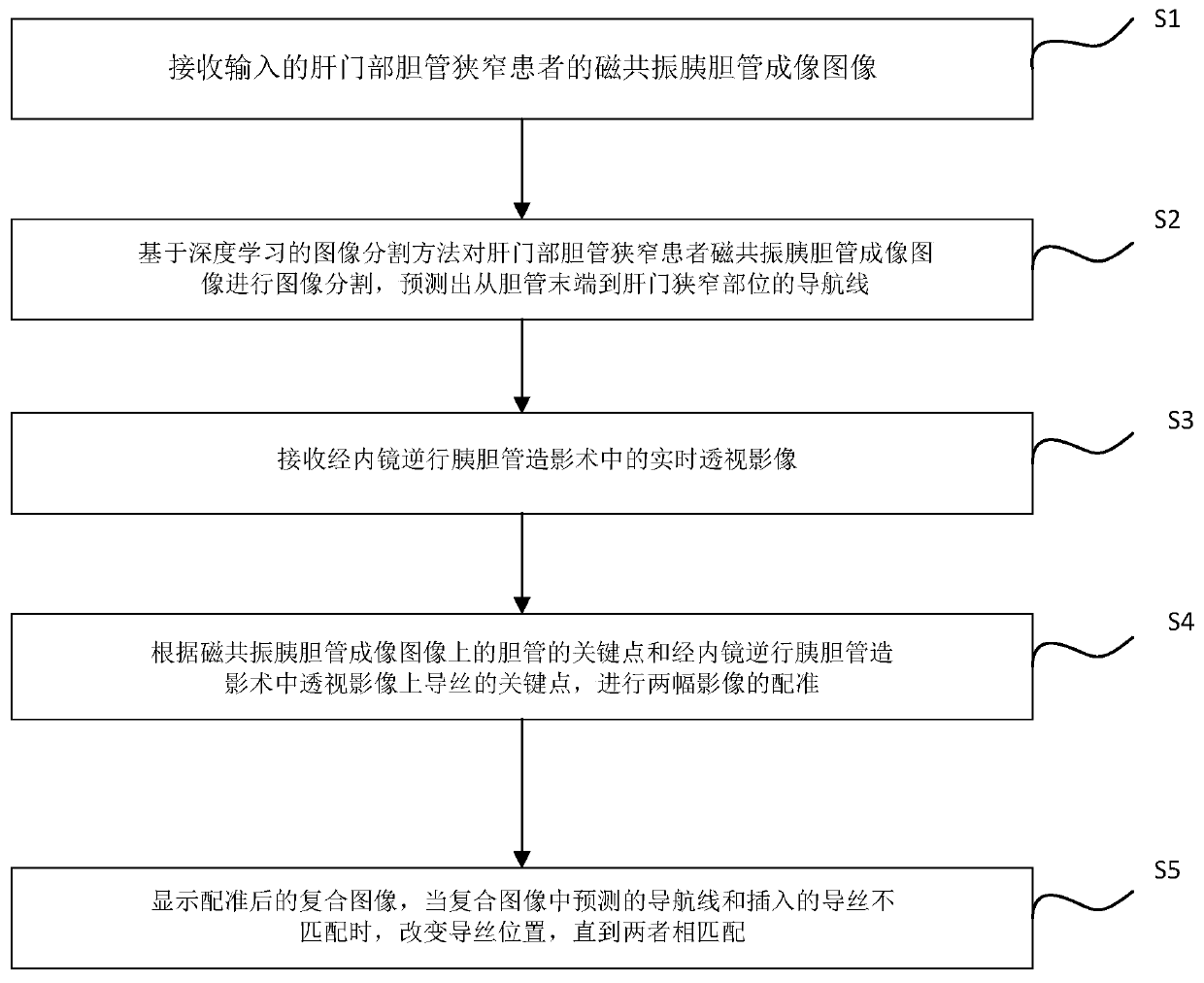 Guide wire navigation method for endoscopic biliary stent implantation for portal stenosis and guide wire navigation system thereof