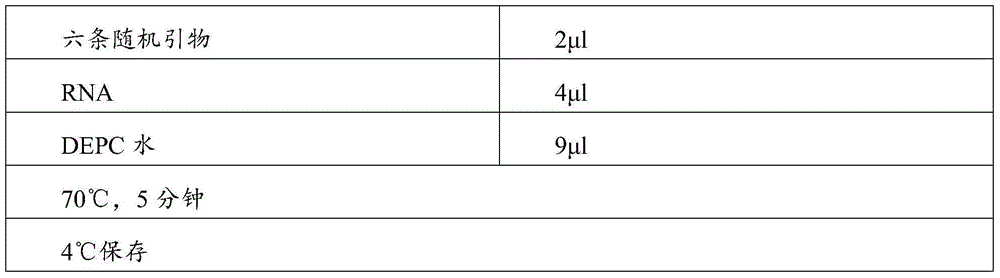 Detection method and primers for TMPRSS2-ERG gene in human urine