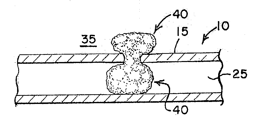 Method For Anchoring Occlusion Plug