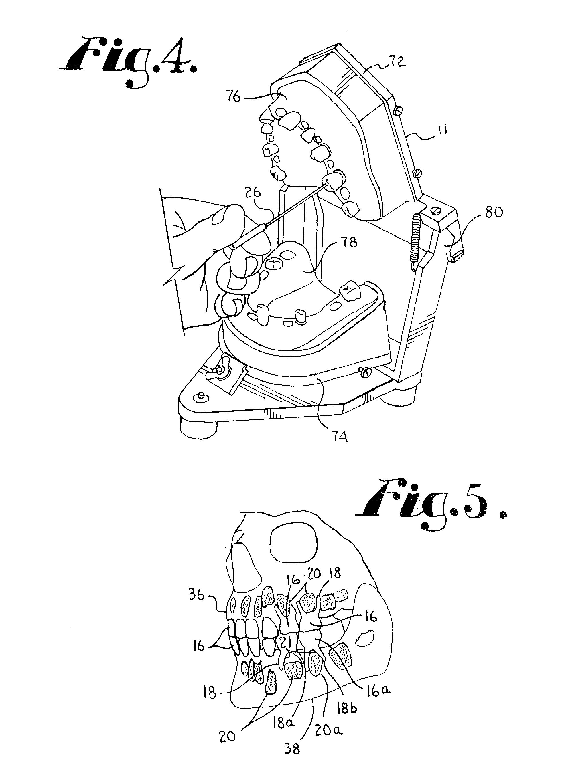 Dental training device