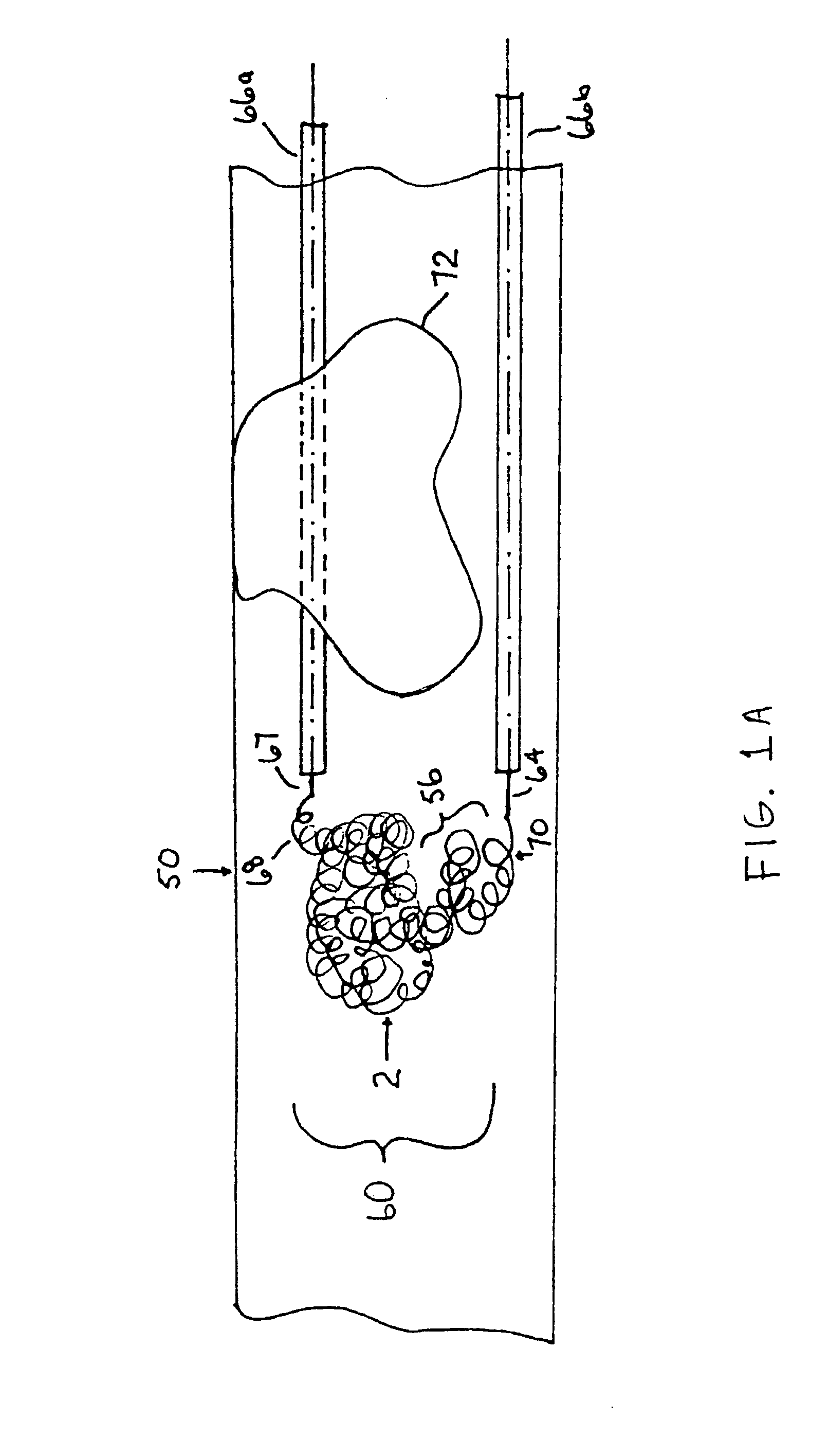 Thrombus removal system and process