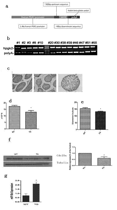 Kit for male azoospermia diagnosis and use method