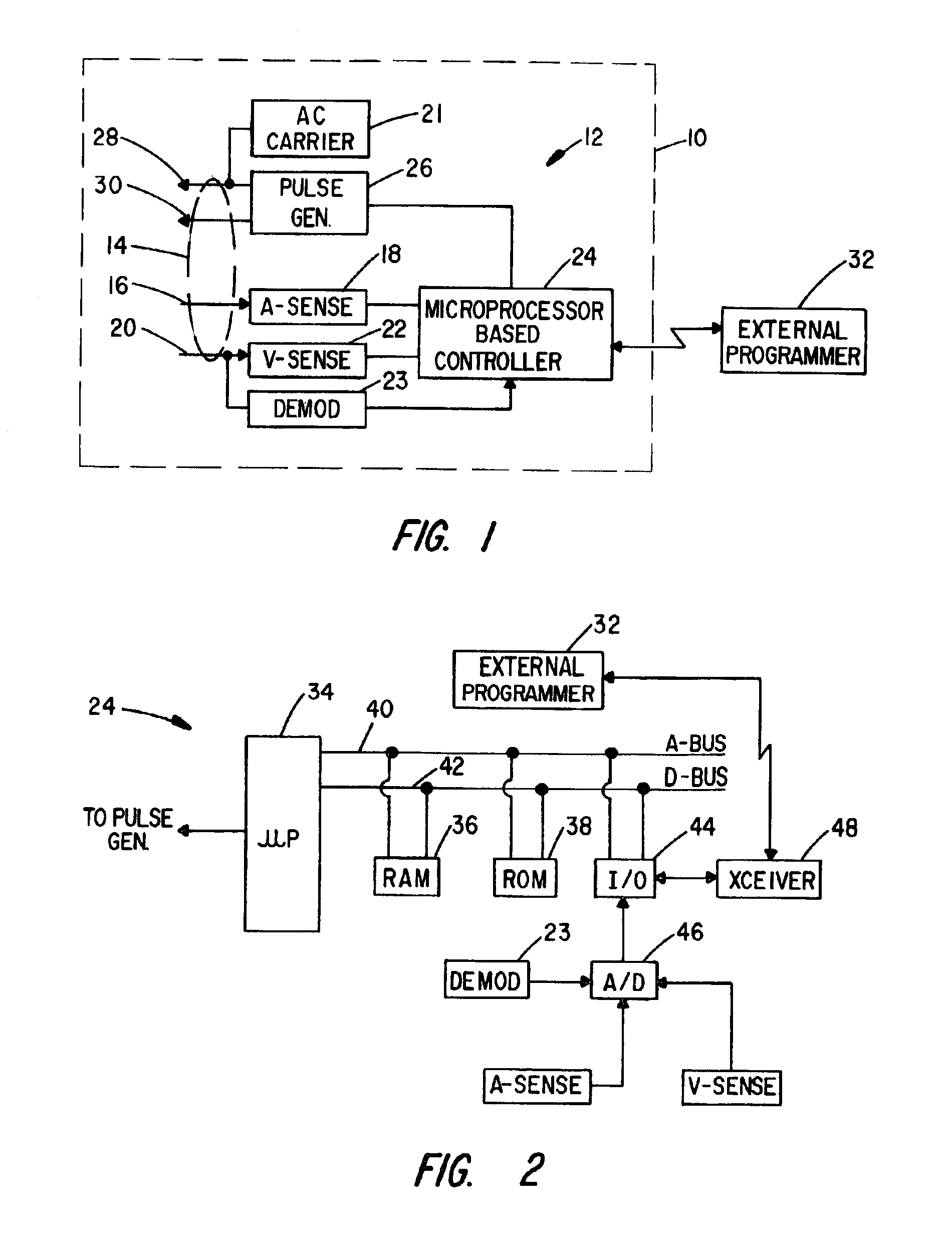 Cardiac rhythm management system with respiration synchronous optimization of cardiac performance using atrial cycle length