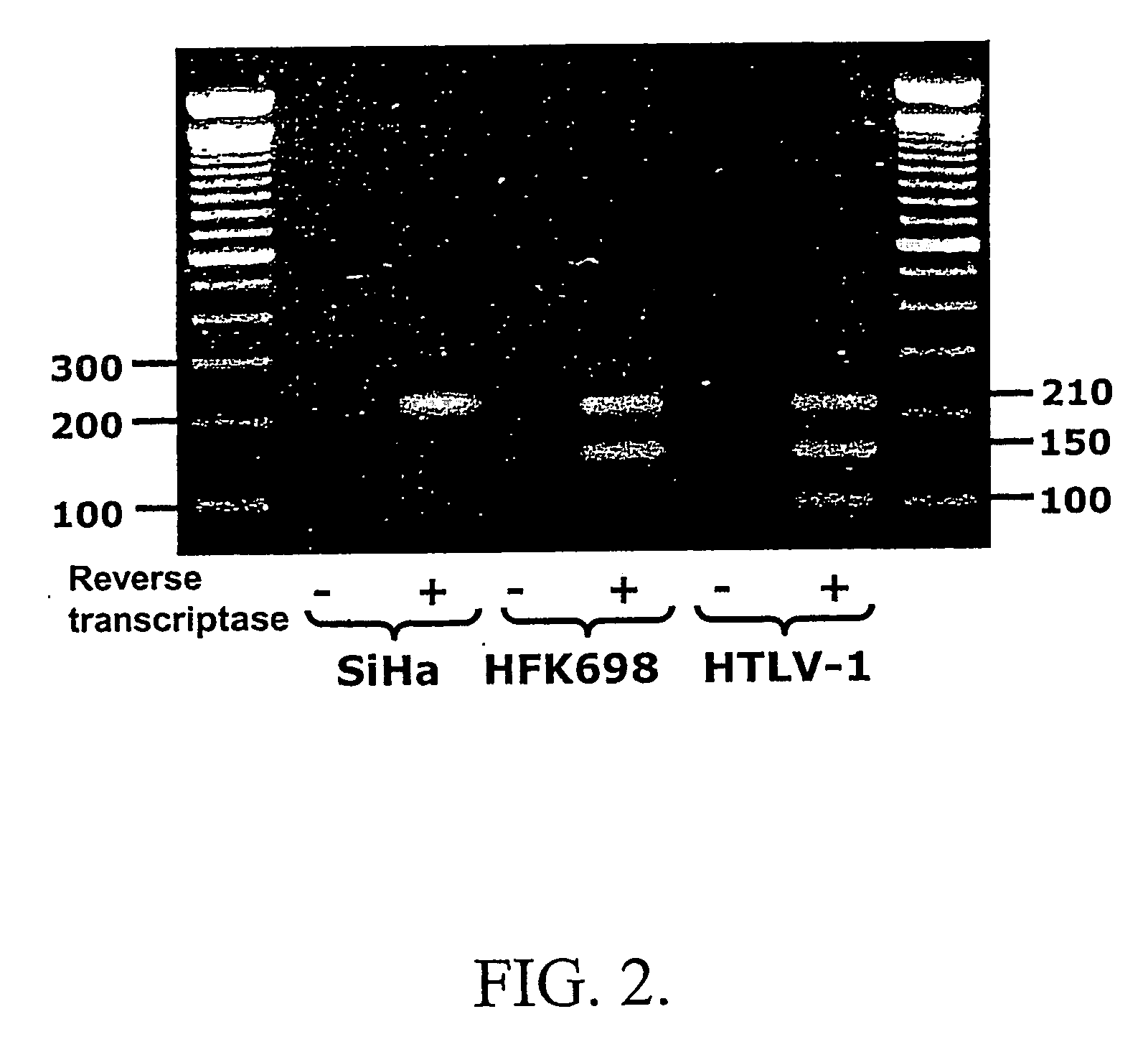 Markers for pre-cancer and cancer calls and the method to interfere with cell proliferation therein